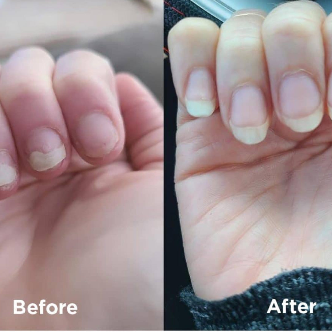 Livélle - Nail Growth Oil