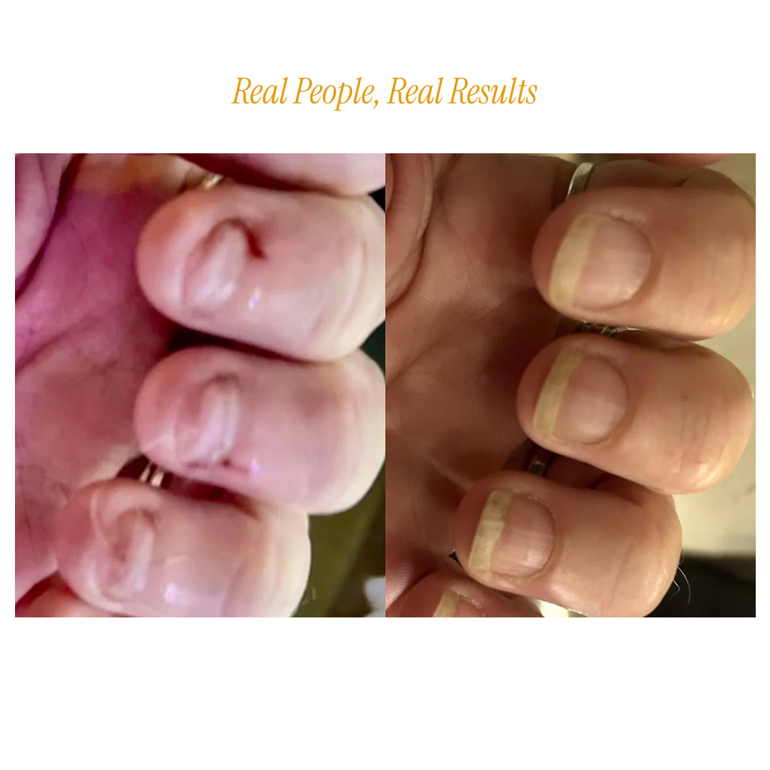 Livélle - Nail Growth Oil