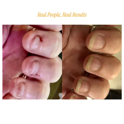 Livélle - Nail Growth Oil