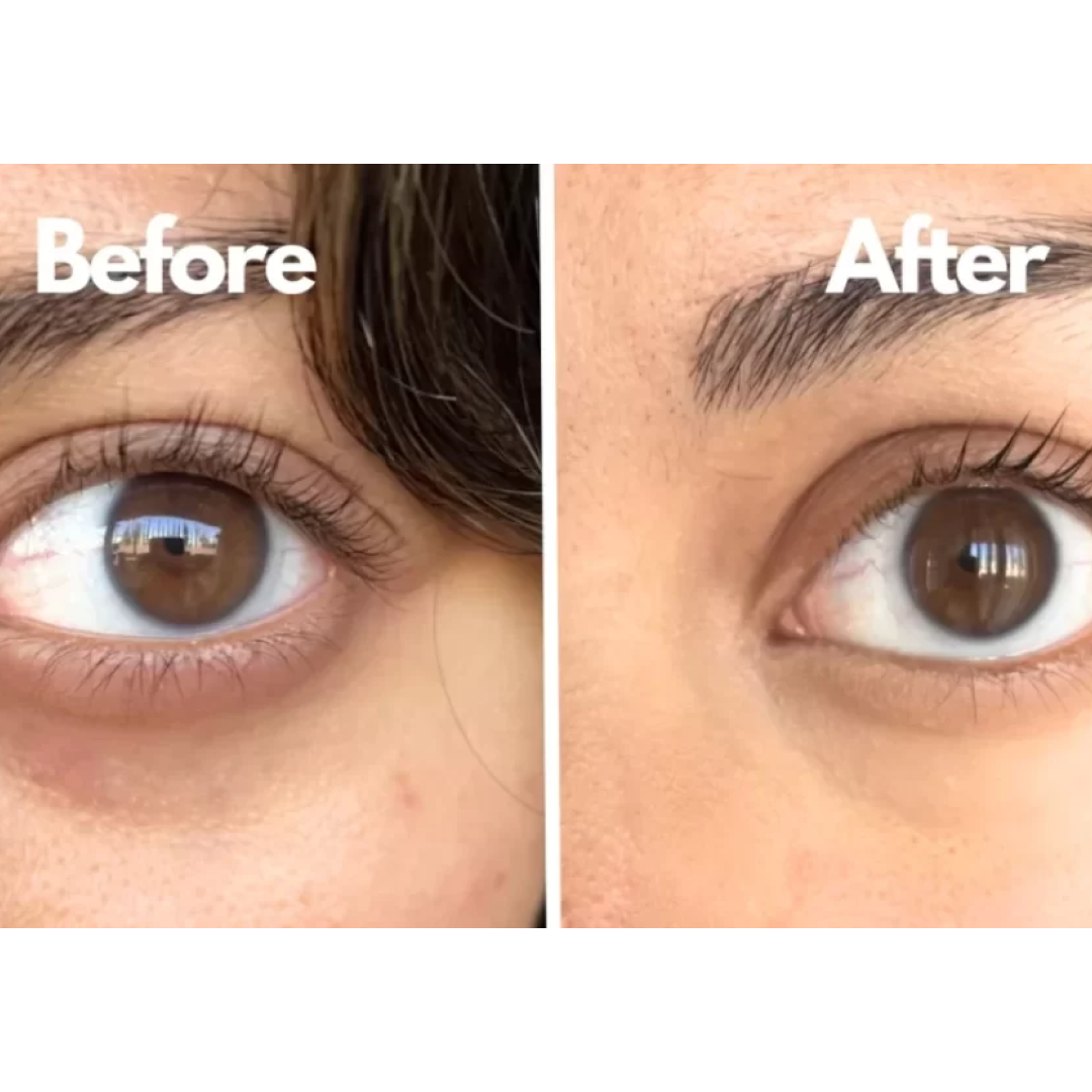 Youree - Snake Venom Peptide 360° Eye Mask